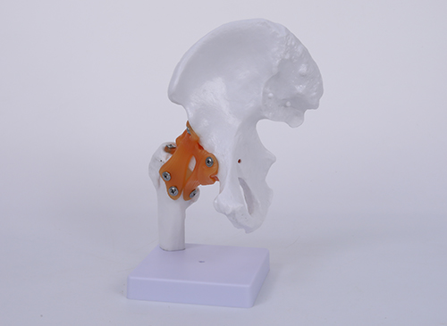 髋关节模型