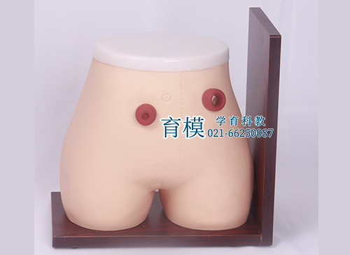 高级瘘管造口术护理模型