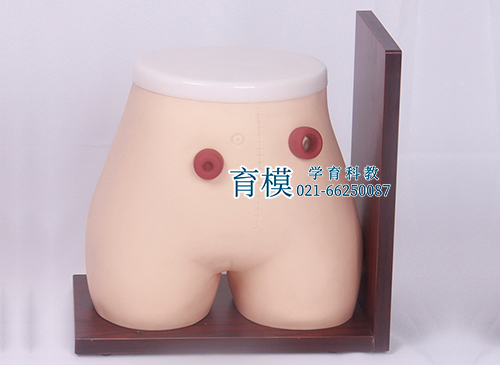 高级瘘管造口术护理模型