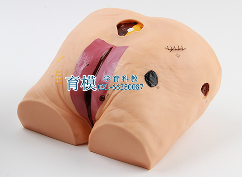 高级压疮（褥疮）护理模型